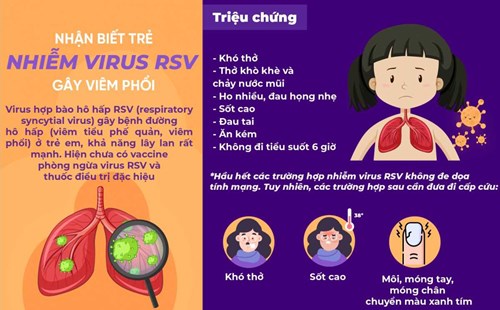 Nhận biết trẻ nhiễm virus RSV gây viêm phổi