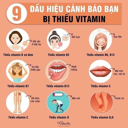 Những dấu hiệu cảnh báo thiếu vitamin