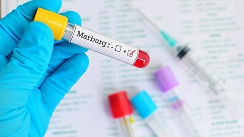 Dịch Virus Marburg: Nhận biết triệu chứng và phòng tránh lây nhiễm