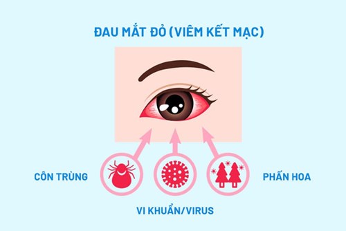 Tuyên truyền các cách phòng bệnh đau mắt đỏ