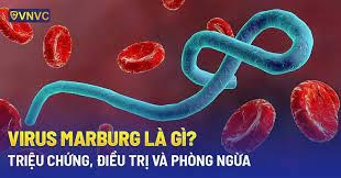 Virus marburg là gì? nguyên nhân, dấu hiệu, cách điều trị