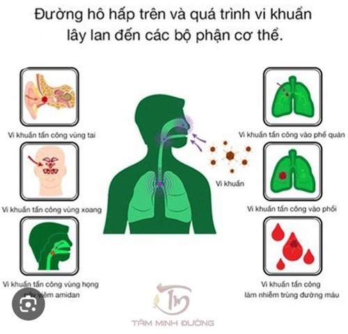 Tuyên truyền về bệnh viêm đường hô hấp khi thời tiết giao mùa