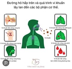 Tuyên truyền về bệnh viêm đường hô hấp khi thời tiết giao mùa