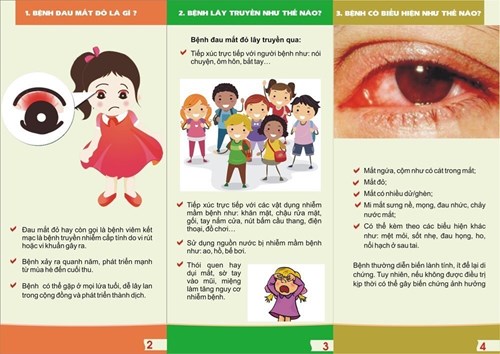 Nguyên nhân, triệu chứng và cách phòng ngừa bệnh đau mắt đỏ