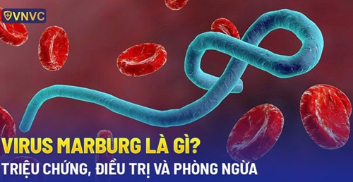 Virus marburg là gì? nguyên nhân, dấu hiệu, cách điều trị