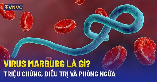 Virus marburg là gì? Nguyên nhân, dấu hiệu, cách điều trị