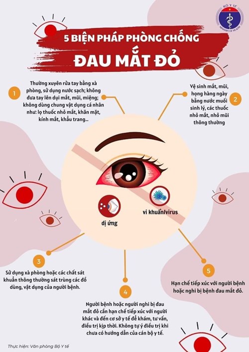 5 Biện pháp phòng, chống bệnh đau mắt đỏ