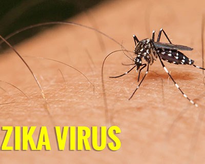 Triệu chứng và cách phát hiện khi bị nhiễm virus Zika