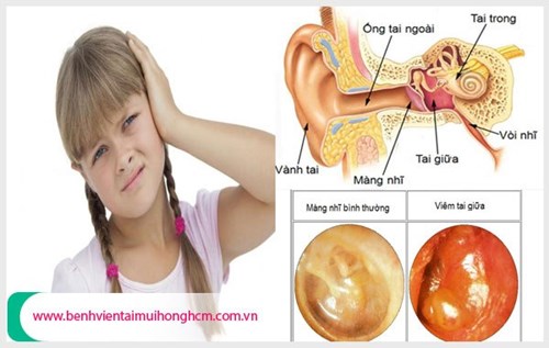 Cách phòng và điềutrị bệnh viêm tai giữa ở trẻ nhỏ, phụ huynh cần quan tâm