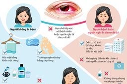 Khuyến cáo về bệnh đau mắt đỏ
