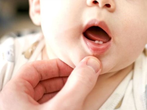 Làm gì khi trẻ chậm mọc răng