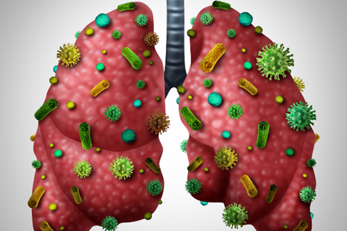 Viêm phổi ở trẻ tái phát nhiều lần và hướng xử trí