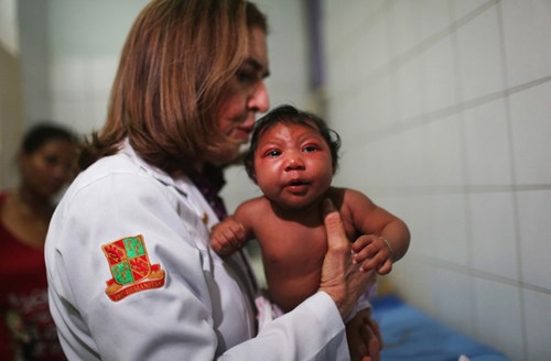 Dấu hiệu, triệu chứng nhiễm virut zika - bệnh đầu nhỏ ở trẻ em