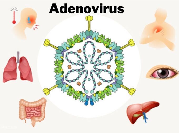Adenovirus có thể gây ra nhiều bệnh khác nhau