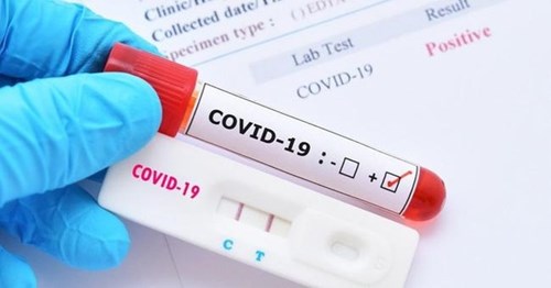 F0 test nhanh âm tính 2 lần, PCR lại dương tính, có phải tái nhiễm SARS-CoV-2?