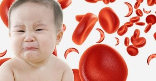 Những dấu hiệu nhận biết thiếu máu ở trẻ em