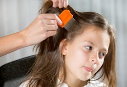 Rụng tóc ở trẻ nhỏ - Nguyên nhân và cách điều trị